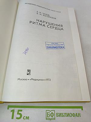 Нарушения ритма сердца