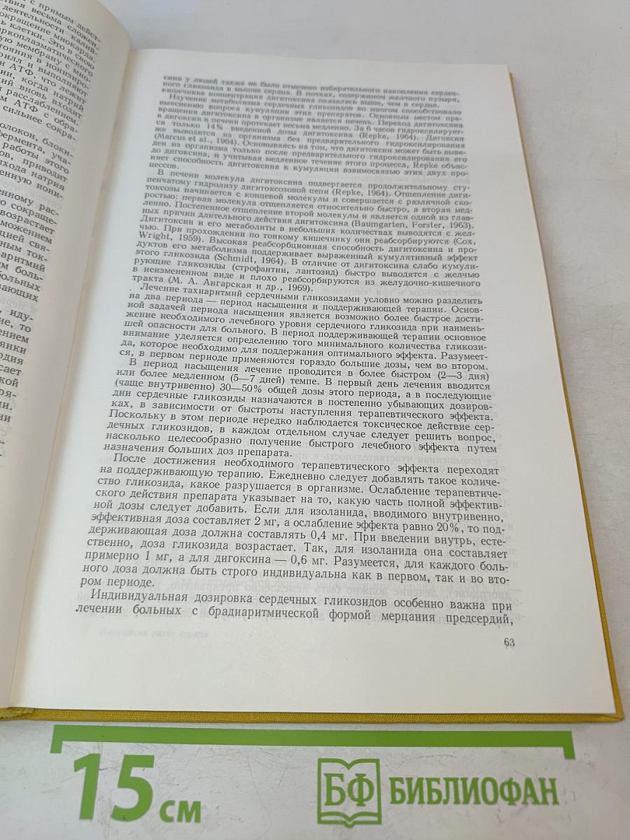 Нарушения ритма сердца