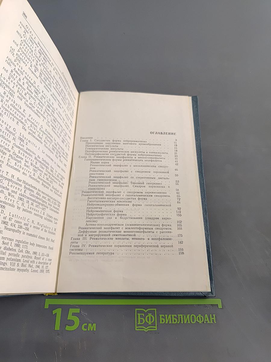 Ревматические заболевания нервной системы