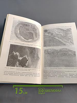 Ревматические заболевания нервной системы
