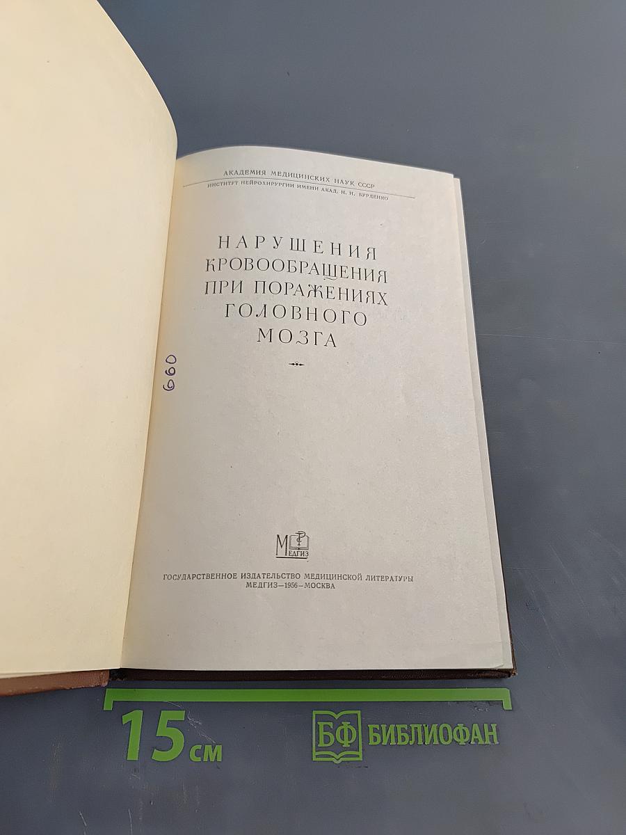 Нарушения кровообращения при поражениях головного мозга