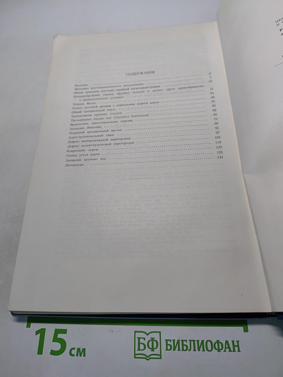 Рентгенологическое исследование при врожденных пороках сердца