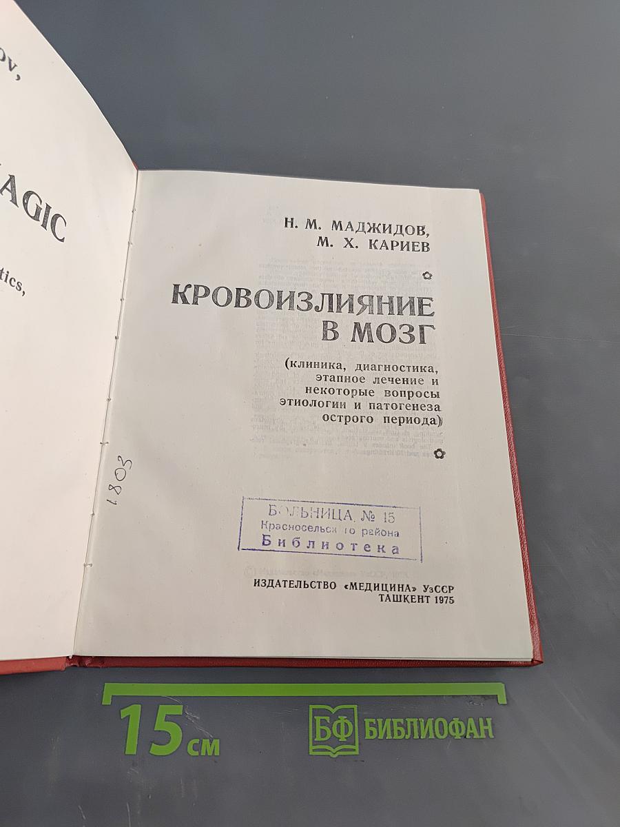Кровоизлияние в мозг