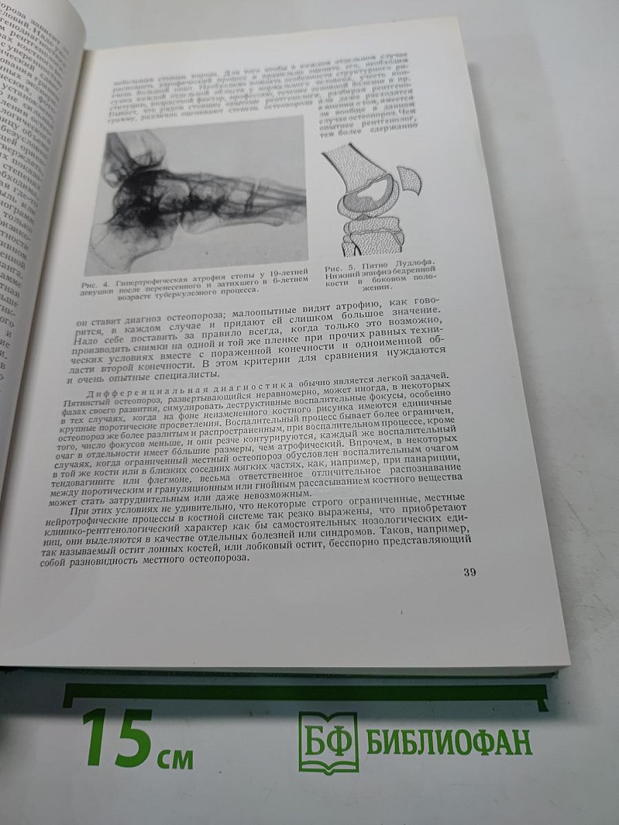 Рентгенодиагностика заболеваний костей и суставов