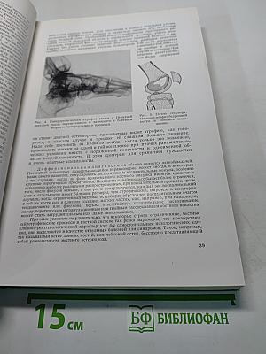 Рентгенодиагностика заболеваний костей и суставов