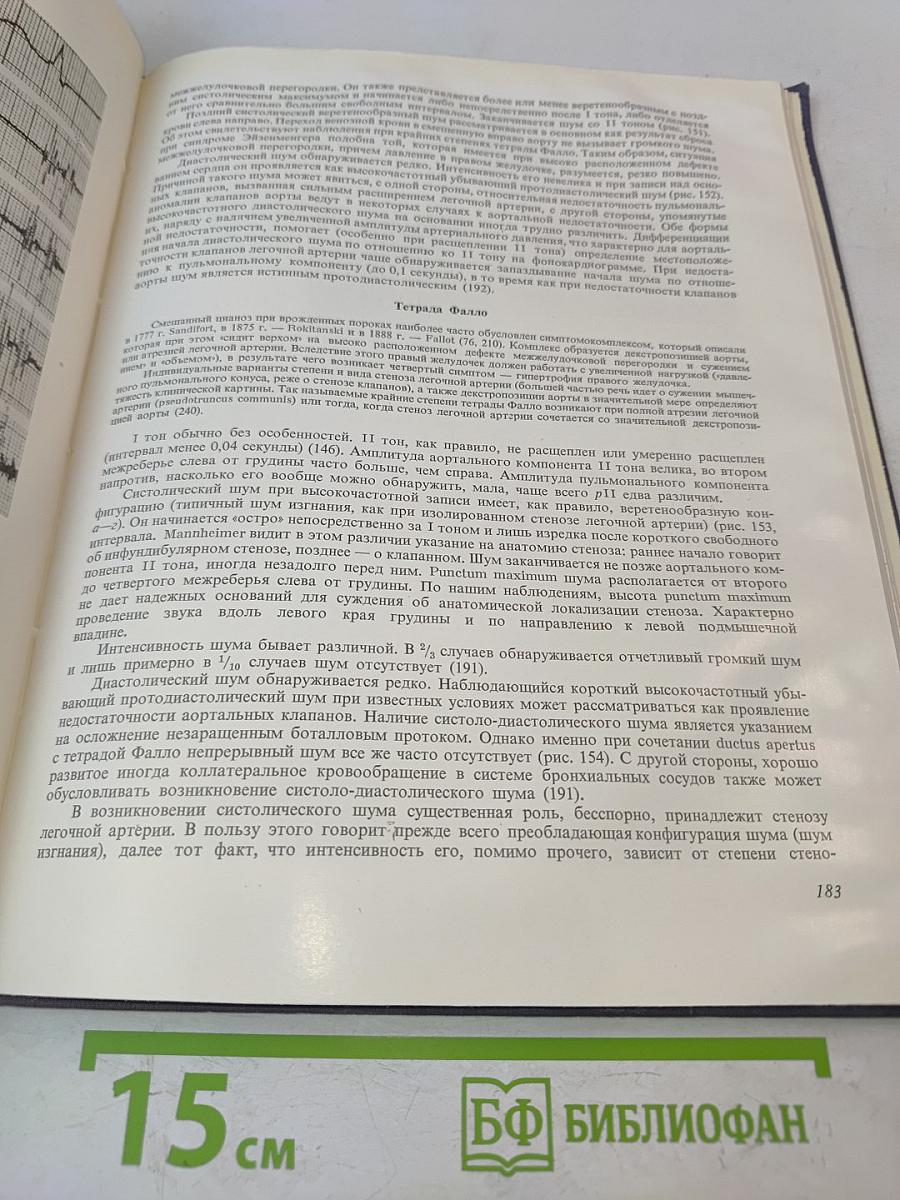 Атлас и руководство по фонокардиографии