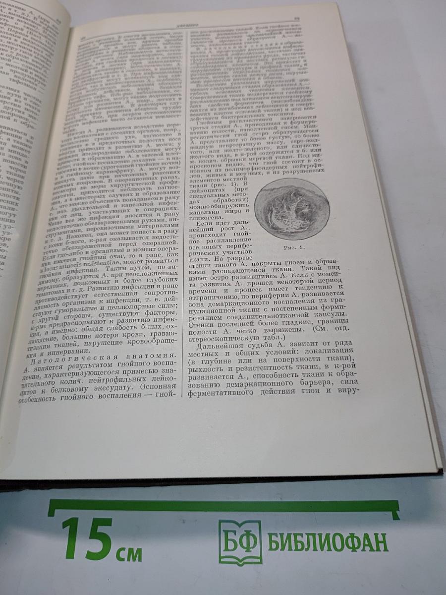 Большая медицинская энциклопедия. Том 1. А - Ангиофиброма