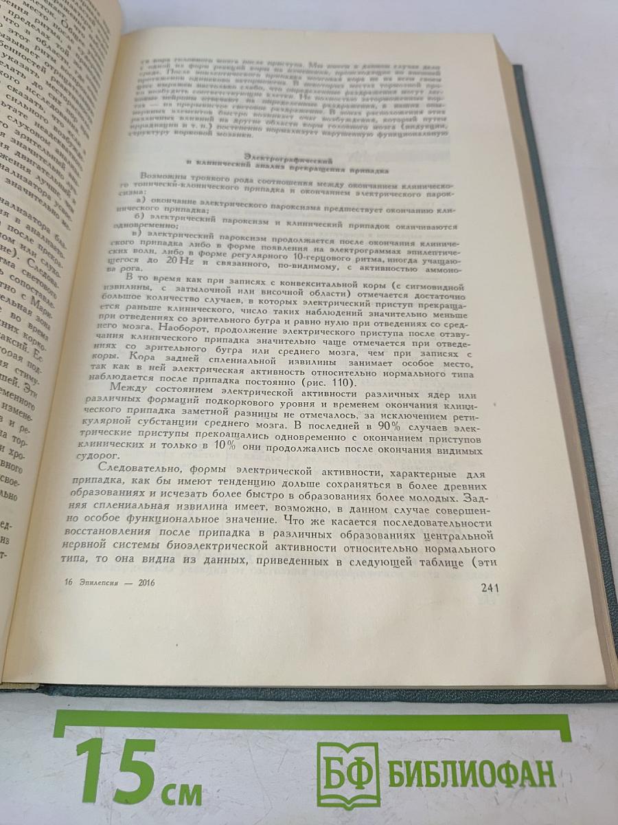 Эпилепсия: Клинические и экспериментальные исследования