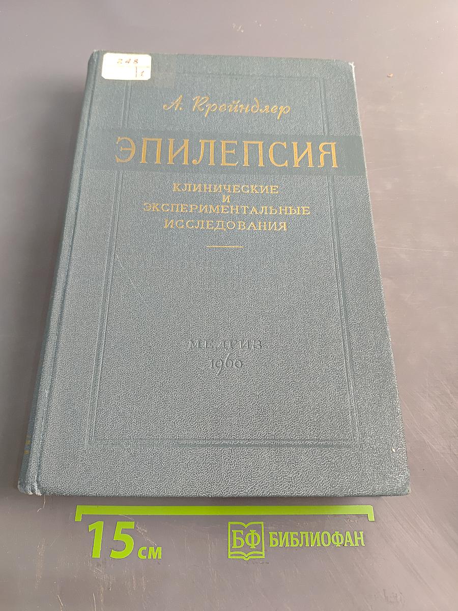 Эпилепсия