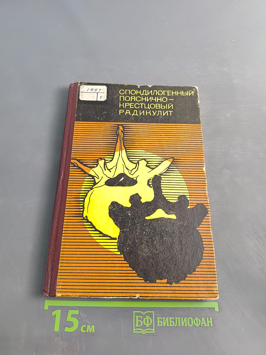 Спондилогенный пояснично-крестцовый радикулит