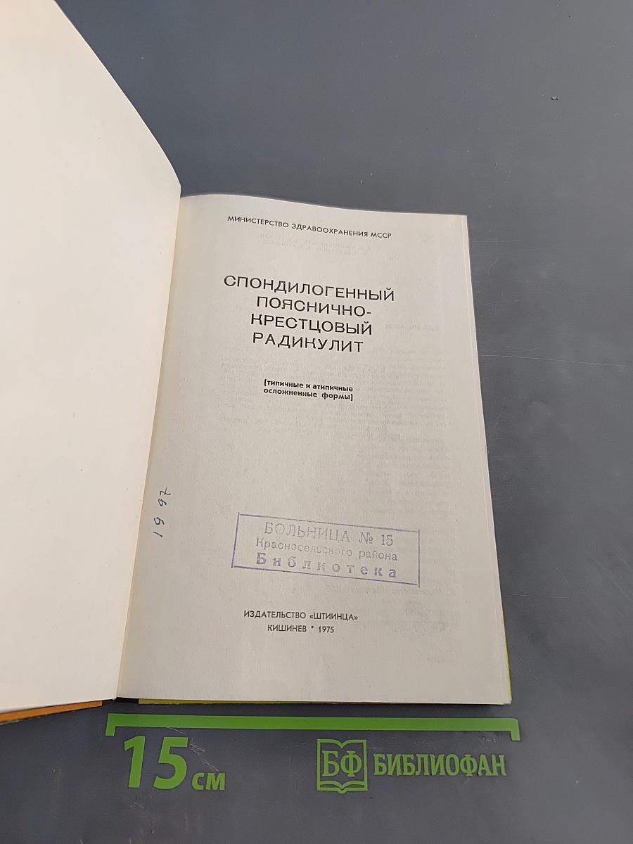 Спондилогенный пояснично-крестцовый радикулит