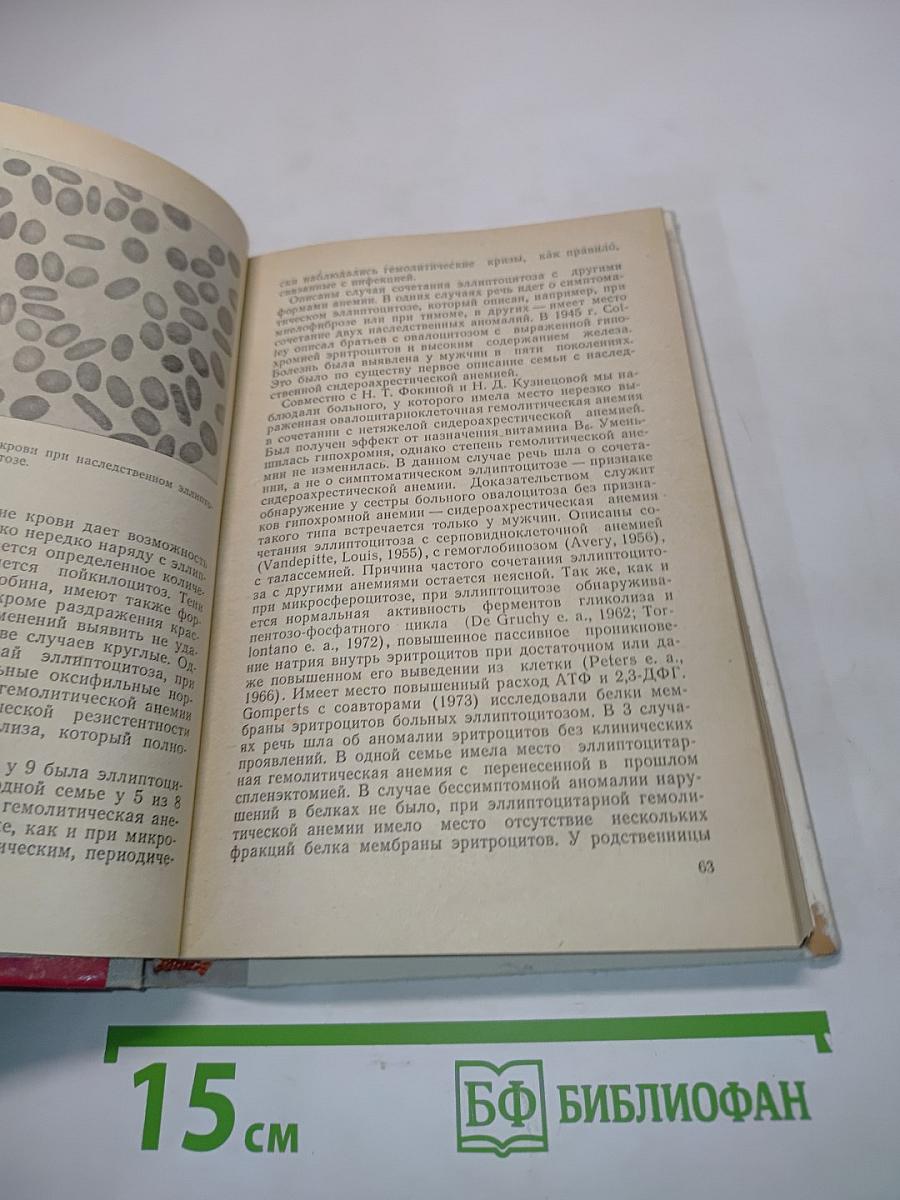 Гемолитические анемии