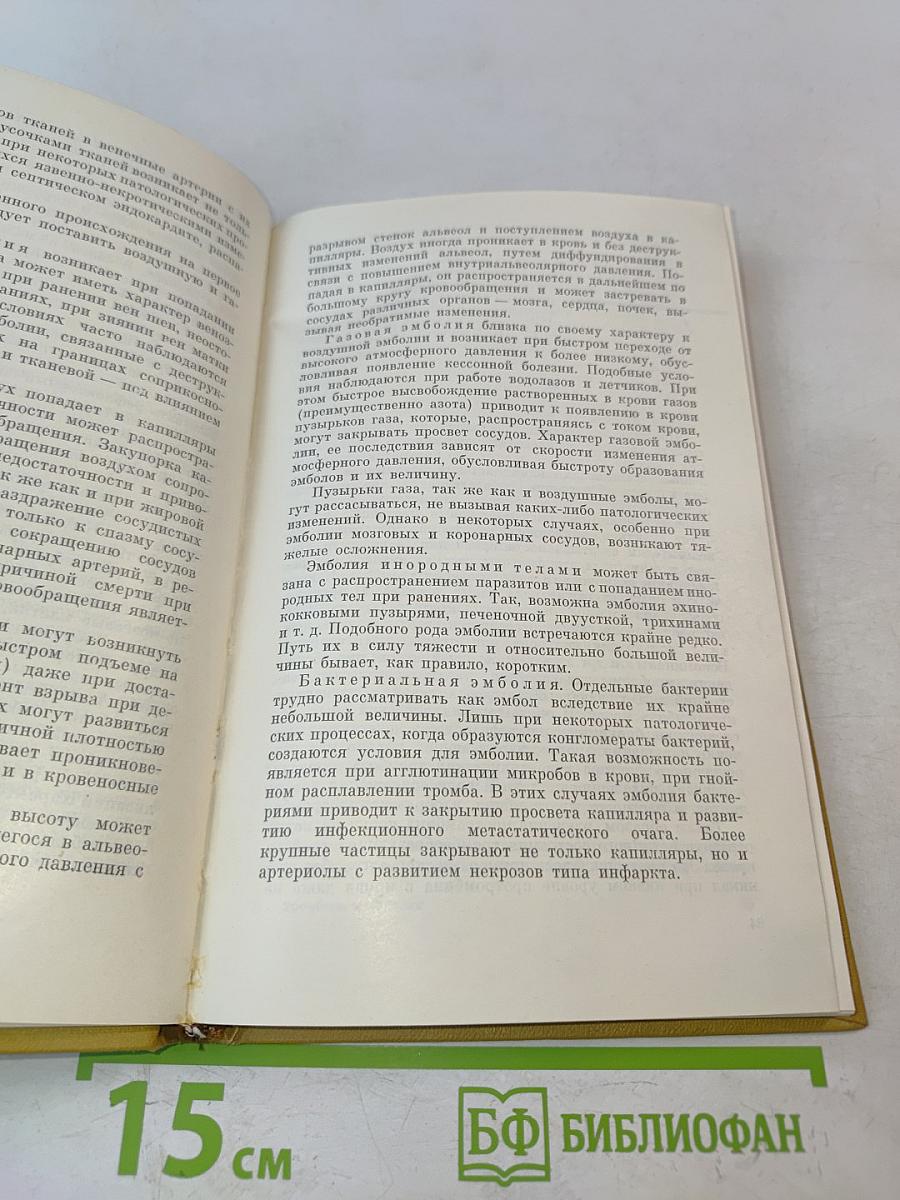 Тромбозы и эмболии в клинике внутренних болезней