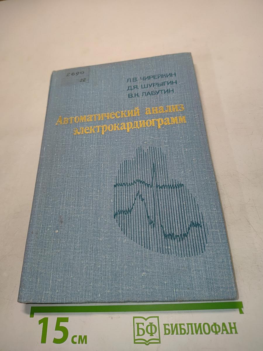 Автоматический анализ электрокардиограмм