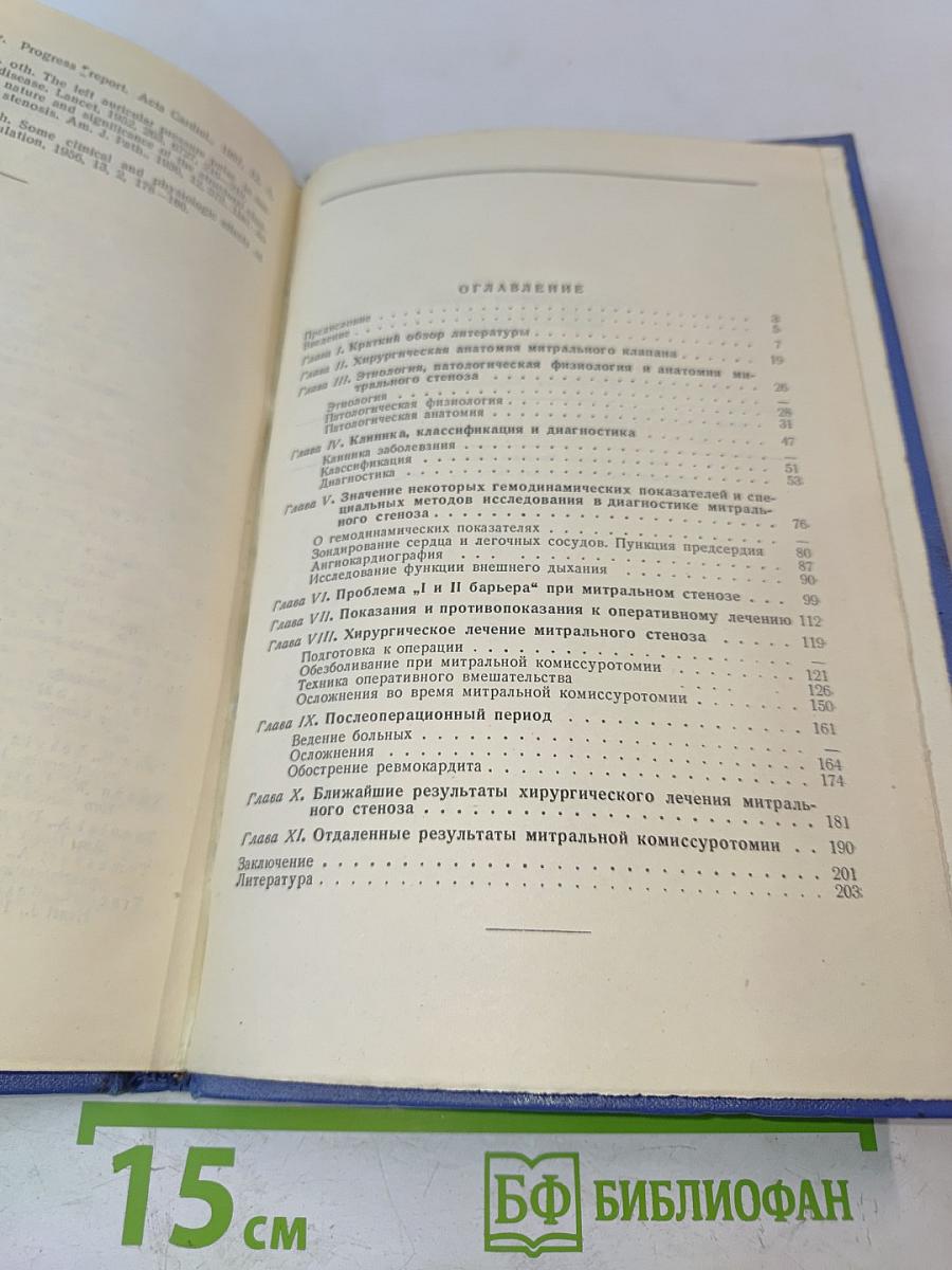 Хирургическое лечение митрального стеноза