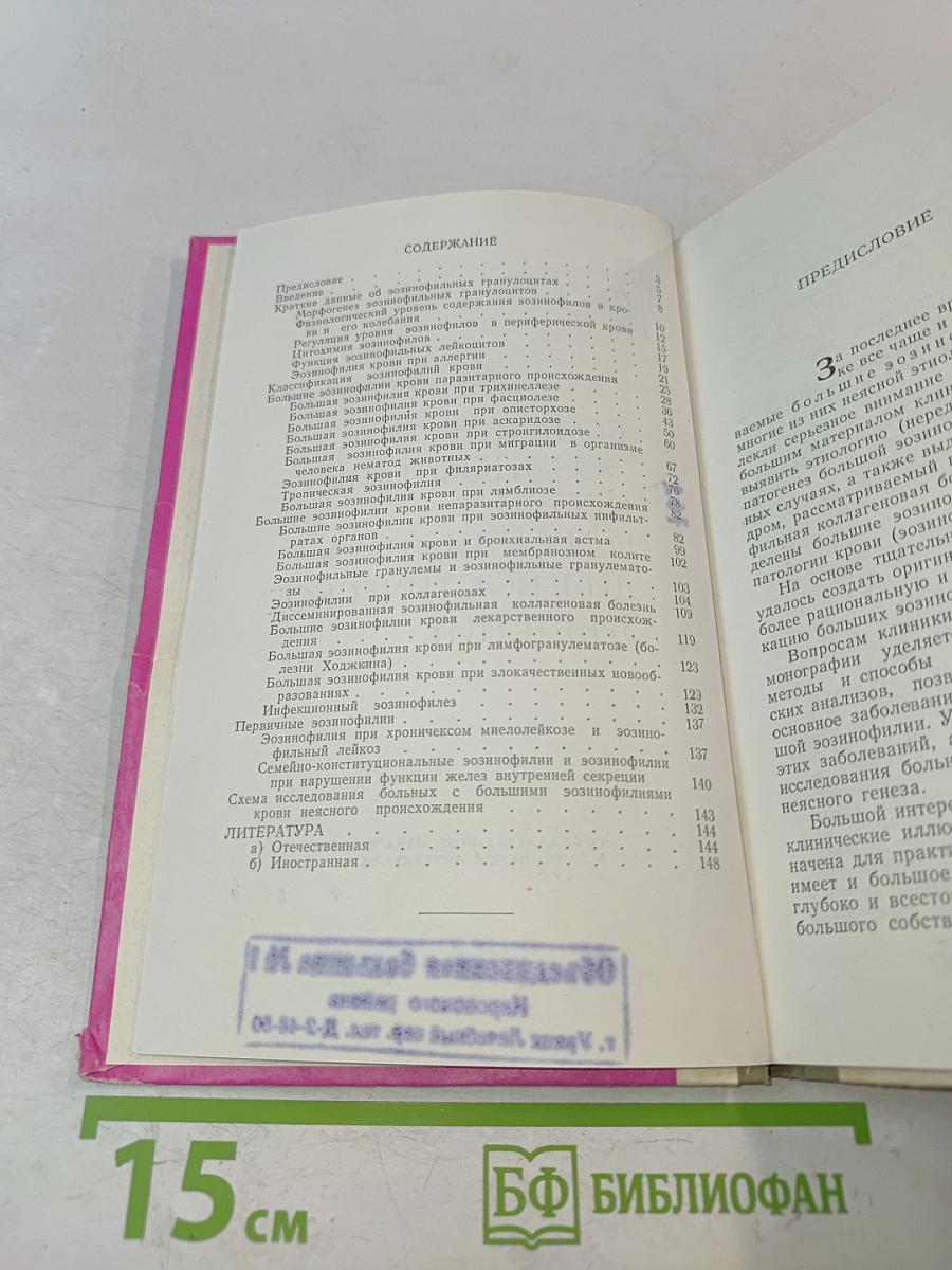 Большие эозинофилии крови и их клинико-диагностическое значение