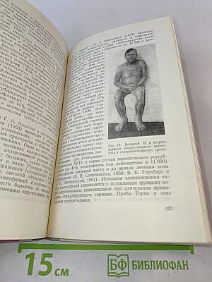 Большие эозинофилии крови и их клинико-диагностическое значение