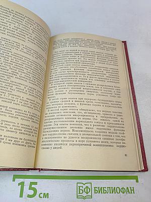 Кардиоспазм