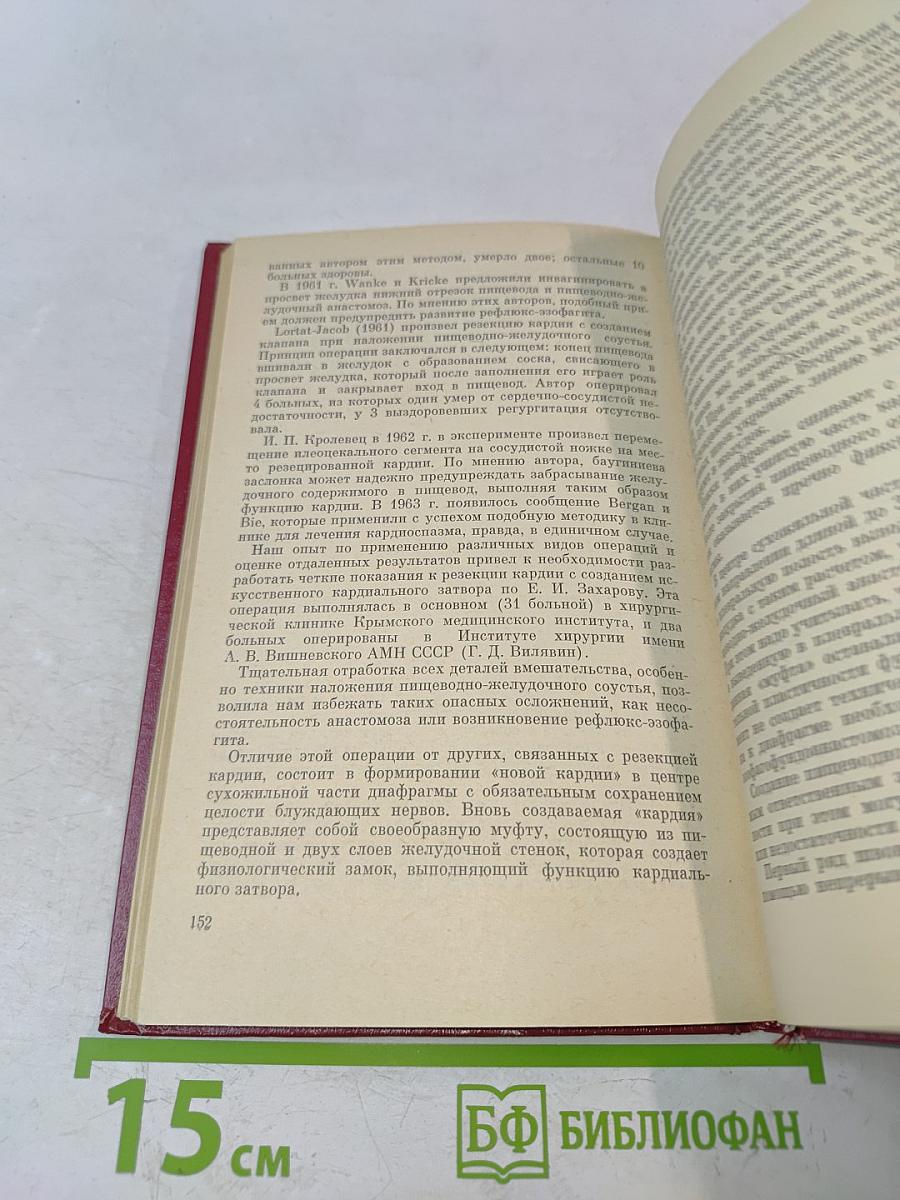 Кардиоспазм