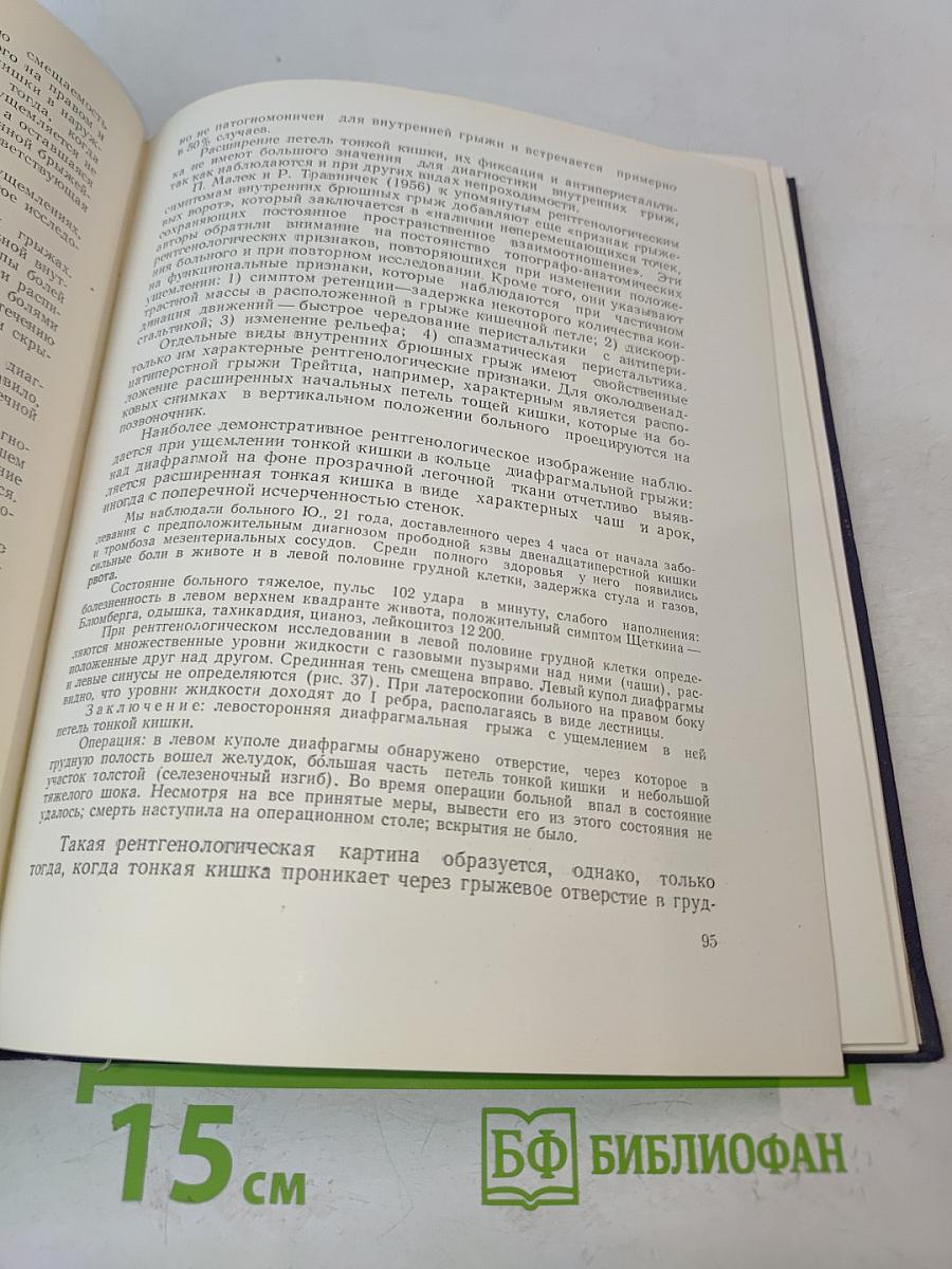 Клинико-рентгенологическая диагностика кишечной непроходимости