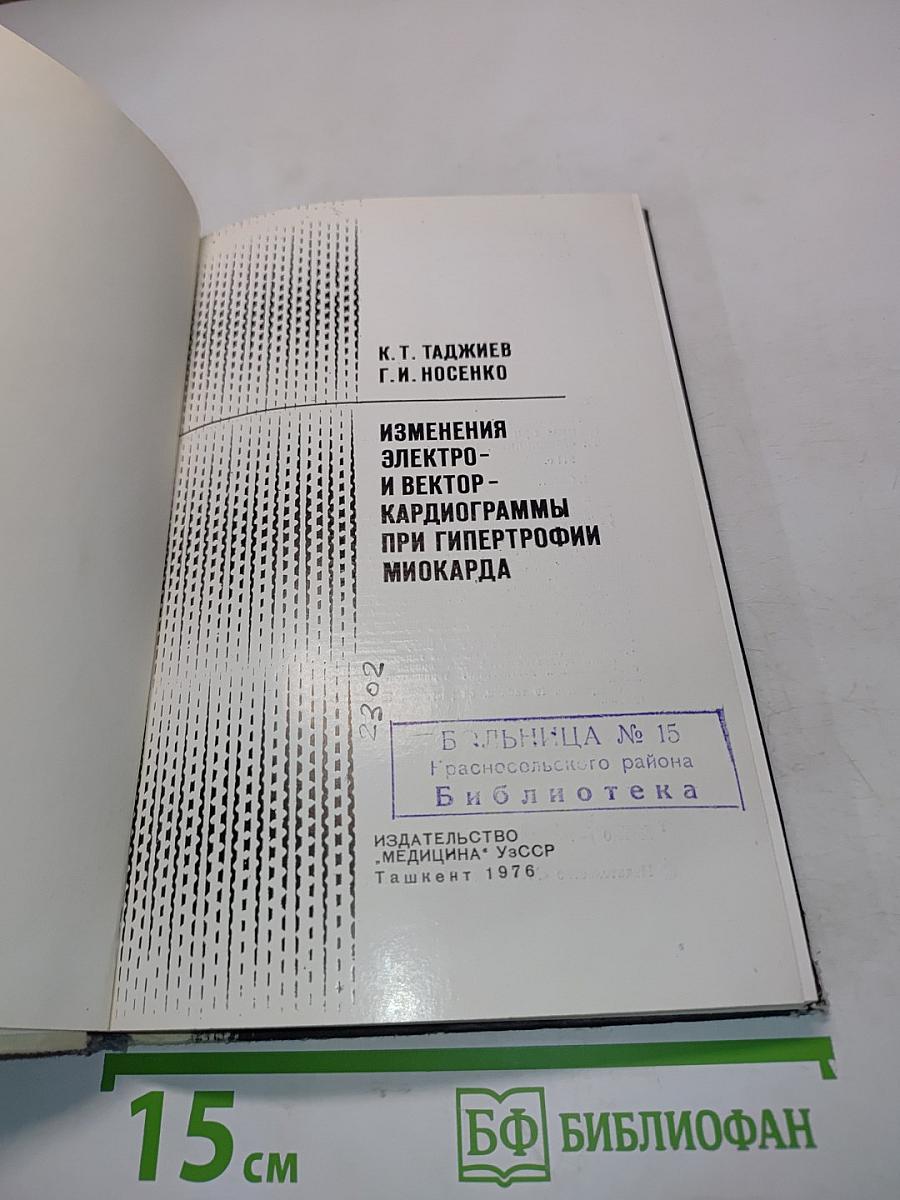 Изменения электро- и векторкардиограммы при гипертрофии миокарда
