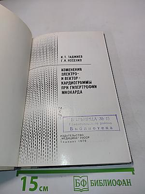 Изменения электро- и векторкардиограммы при гипертрофии миокарда