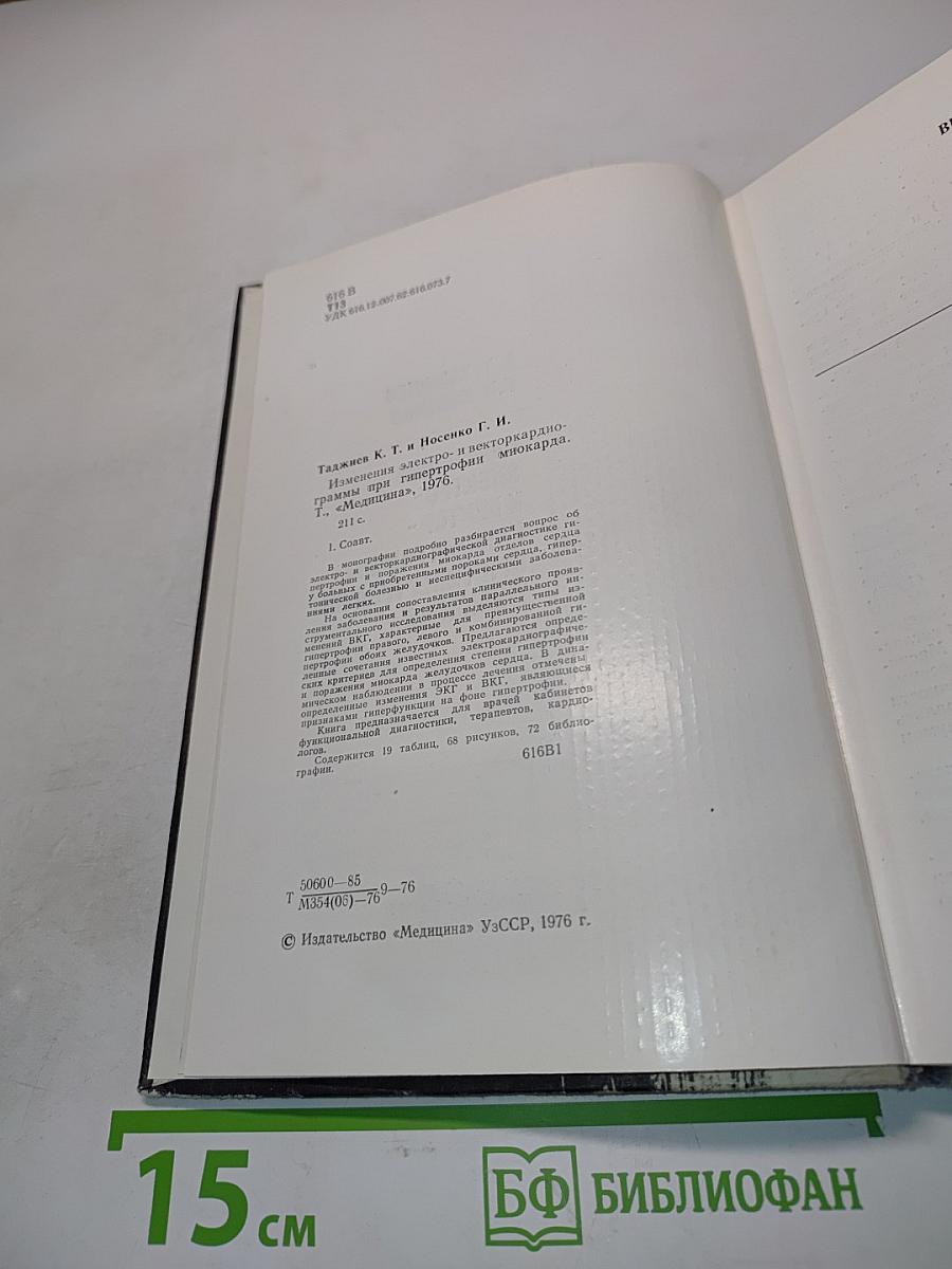 Изменения электро- и векторкардиограммы при гипертрофии миокарда