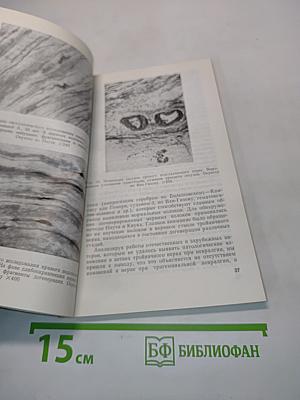 Невралгия тройничного нерва