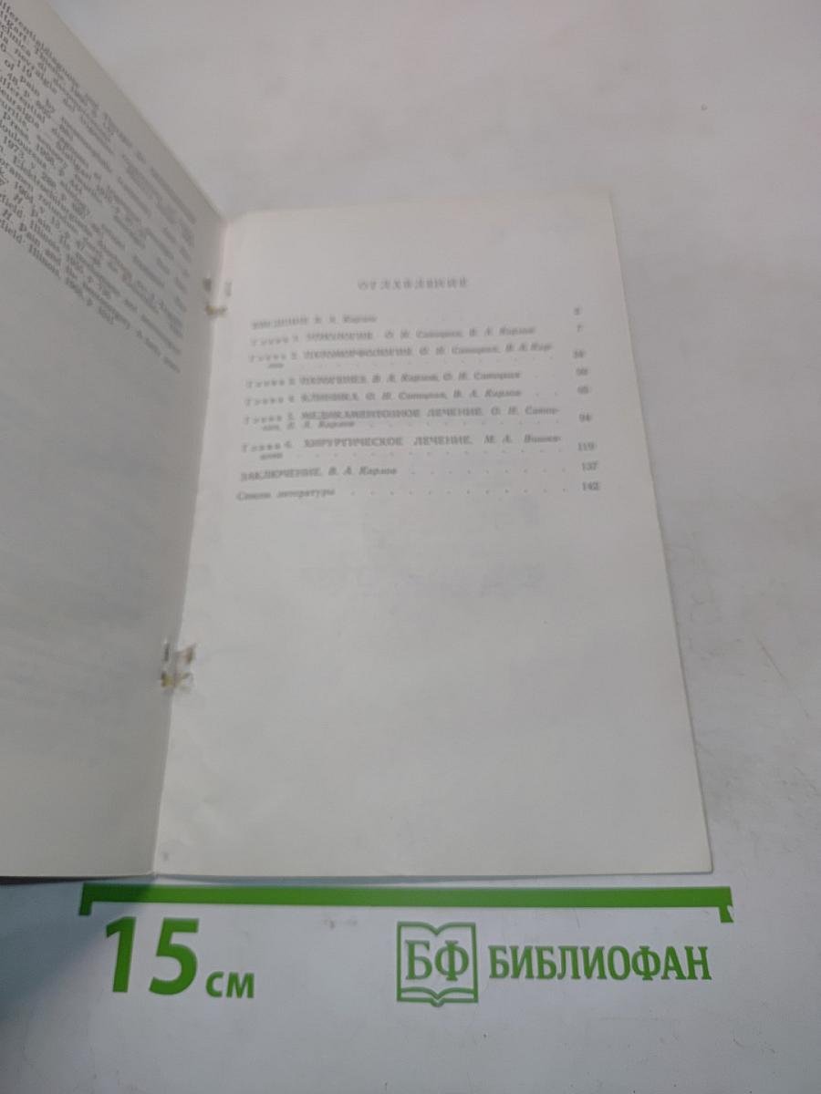 Невралгия тройничного нерва