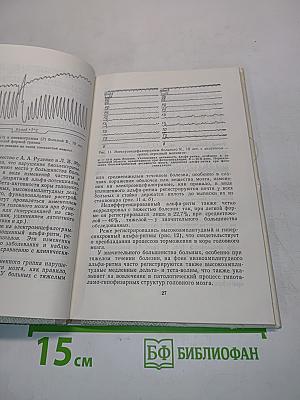 Поражение нервной системы при гриппе и других респираторных вирусных инфекциях