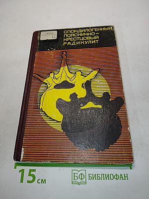 Спондилогенный пояснично-крестцовый радикулит