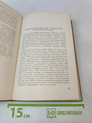 Грудная жаба и инфаркт миокарда