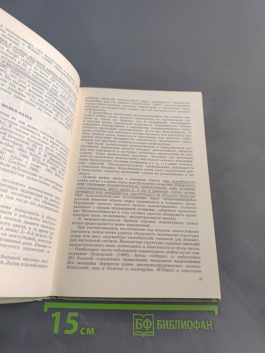 Преклинический рак шейки матки