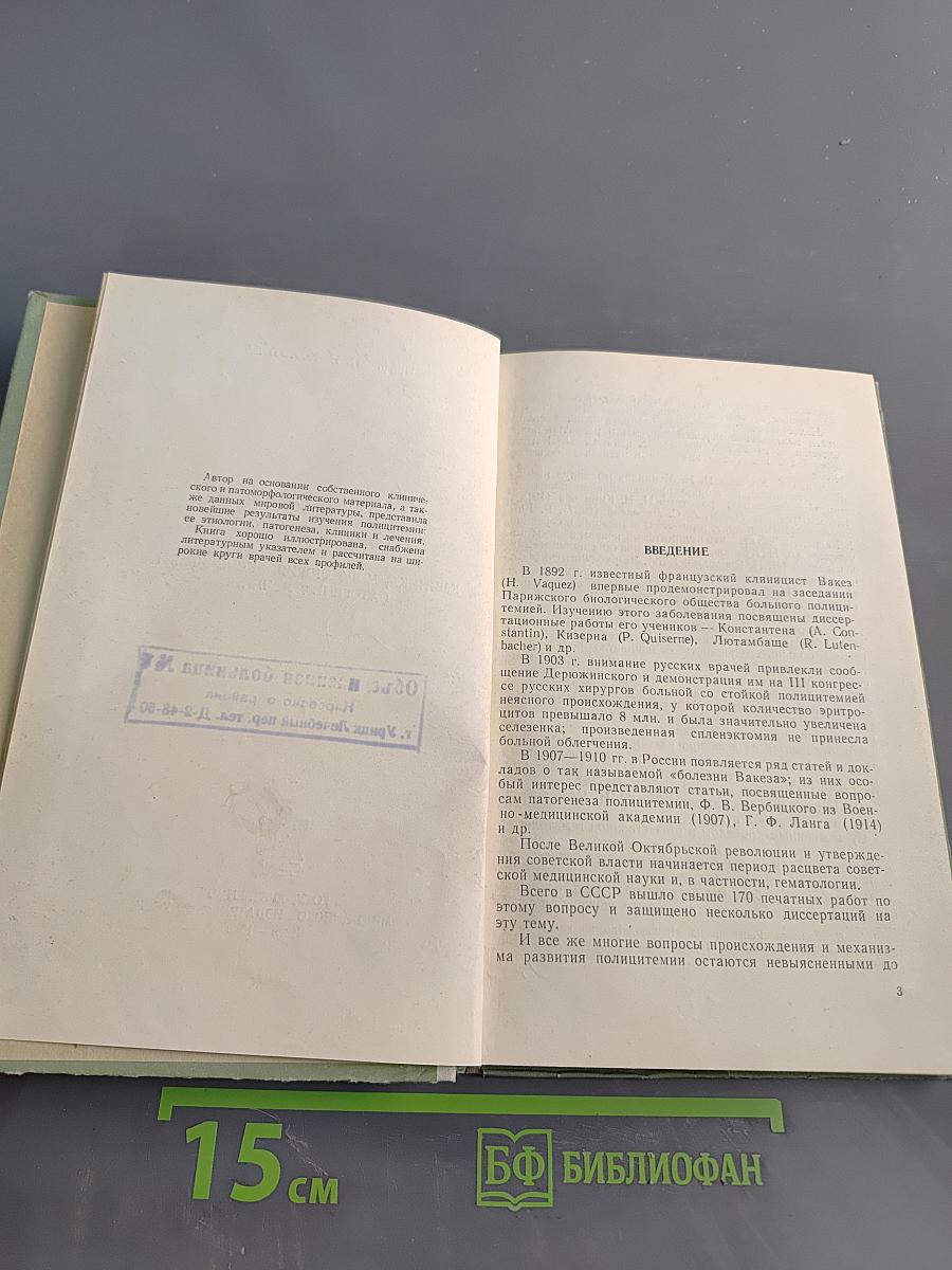 Полицитемия (Эритремия)