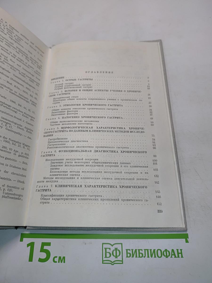 Гастриты