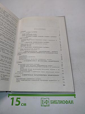 Гастриты