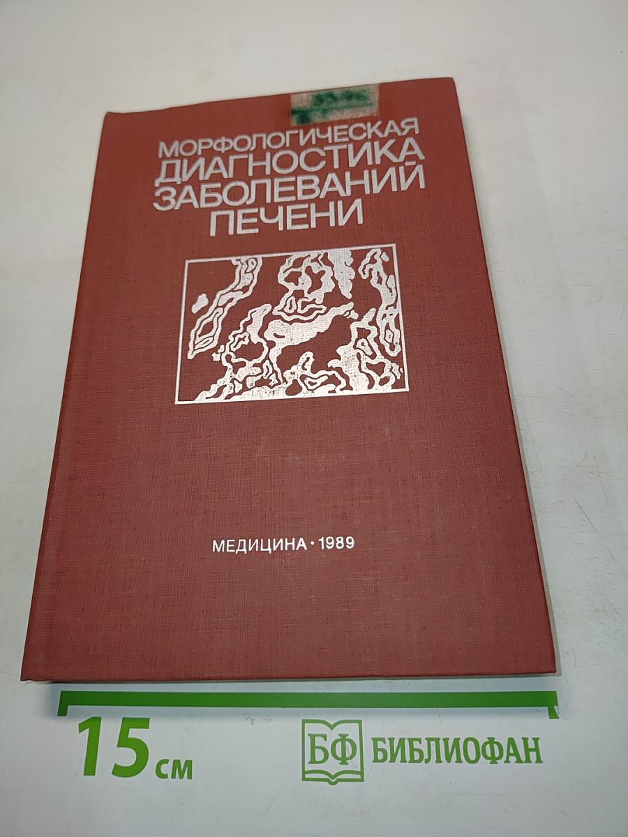 Морфологическая диагностика заболеваний печени