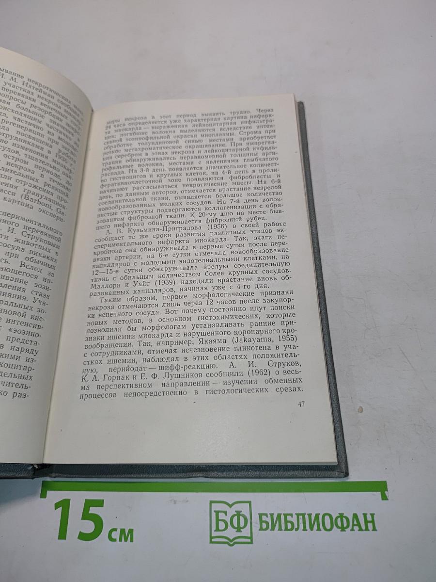 Экспериментальные некрозы миокарда