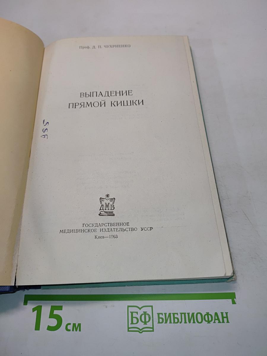 Выпадение прямой кишки