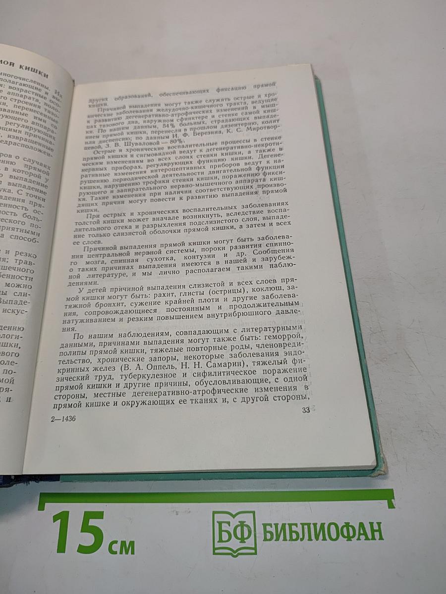 Выпадение прямой кишки