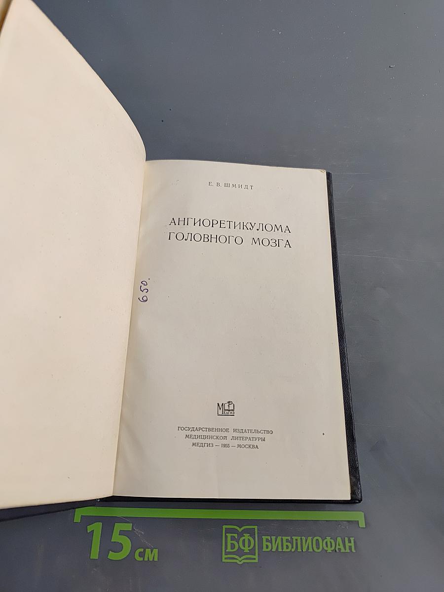 Ангиоретикулома головного мозга