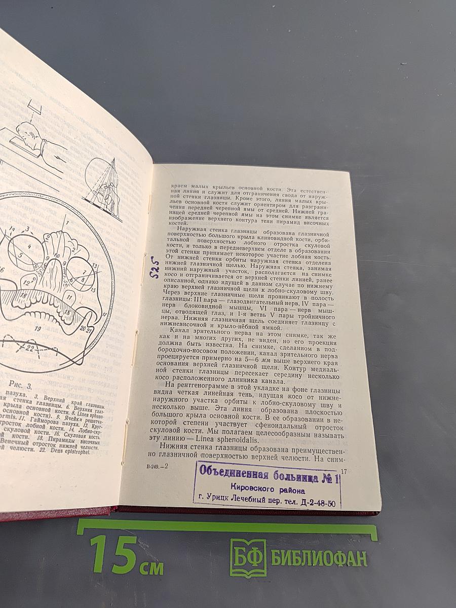 Рентгенодиагностика повреждений мозгового черепа и некоторые вопросы пневмоэнцефалографии