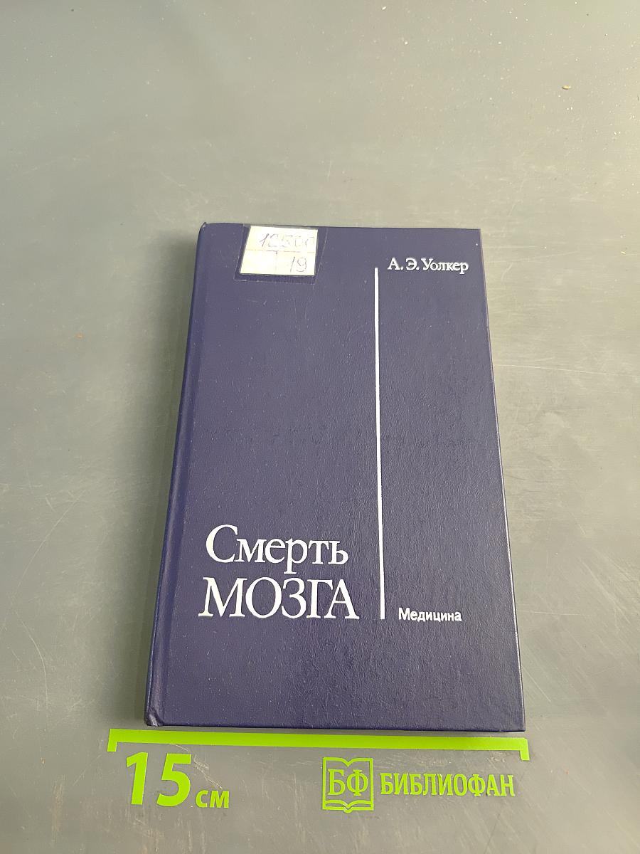 Смерть мозга