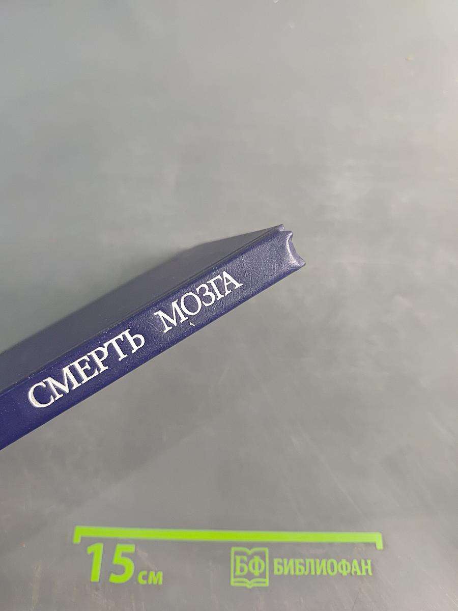 Смерть мозга