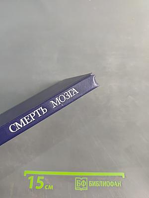Смерть мозга