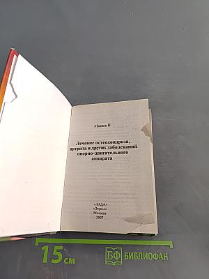 Лечение остеохондроза, артрита и других заболеваний опорно-двигательного аппарата