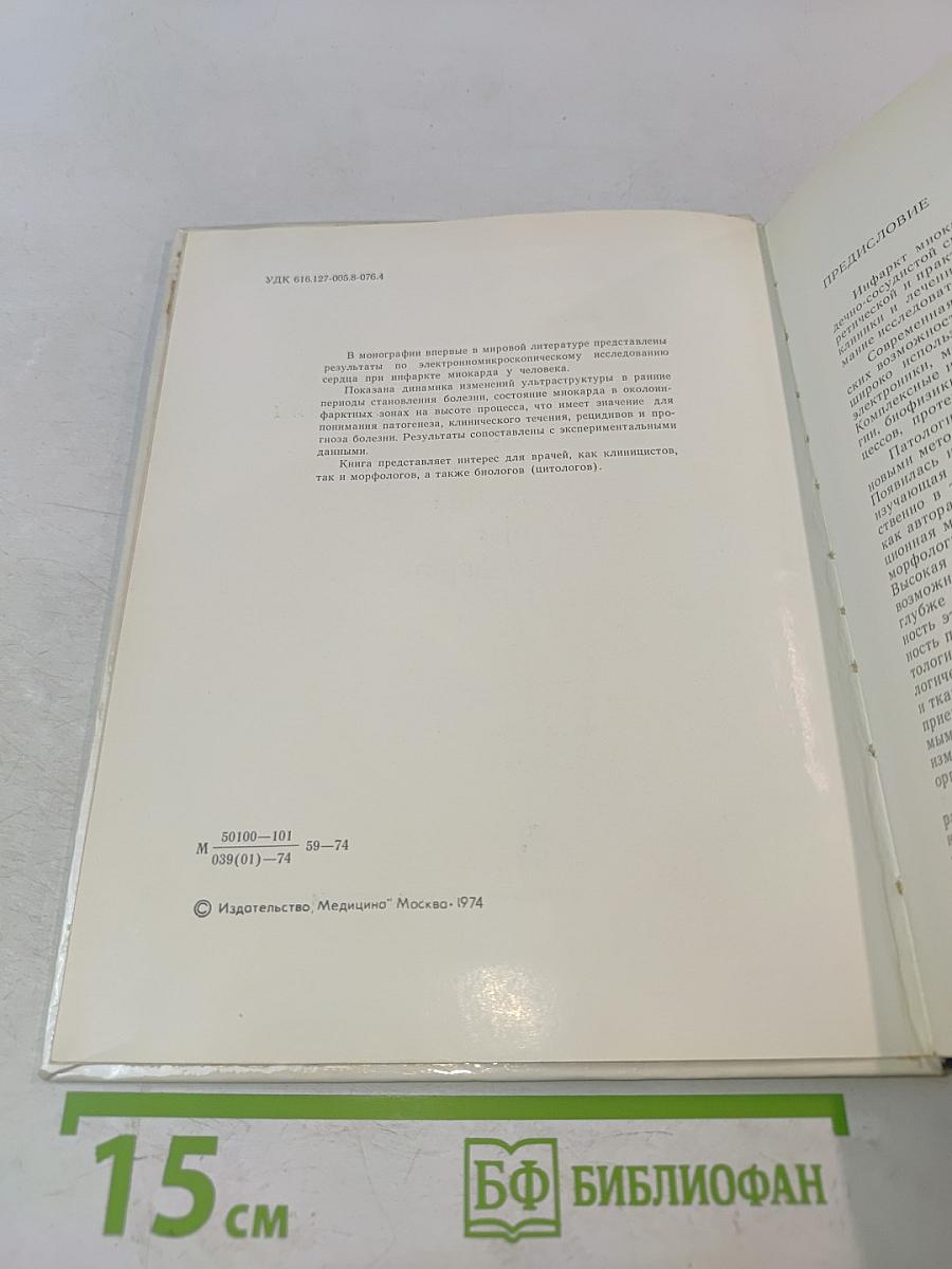 Электронно-микроскопический анализ изменений сердца при инфаркте