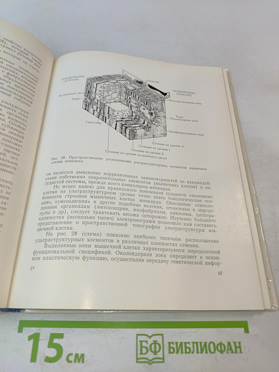 Электронно-микроскопический анализ изменений сердца при инфаркте