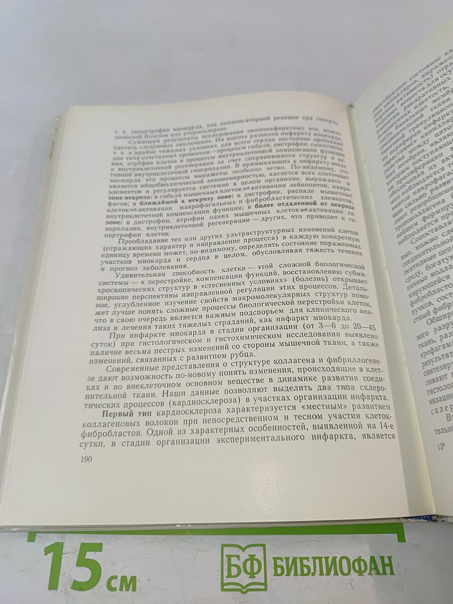 Электронно-микроскопический анализ изменений сердца при инфаркте