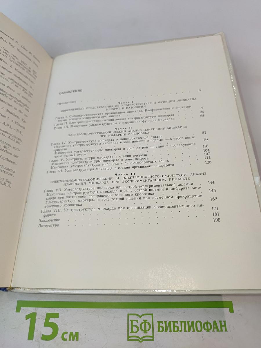 Электронно-микроскопический анализ изменений сердца при инфаркте
